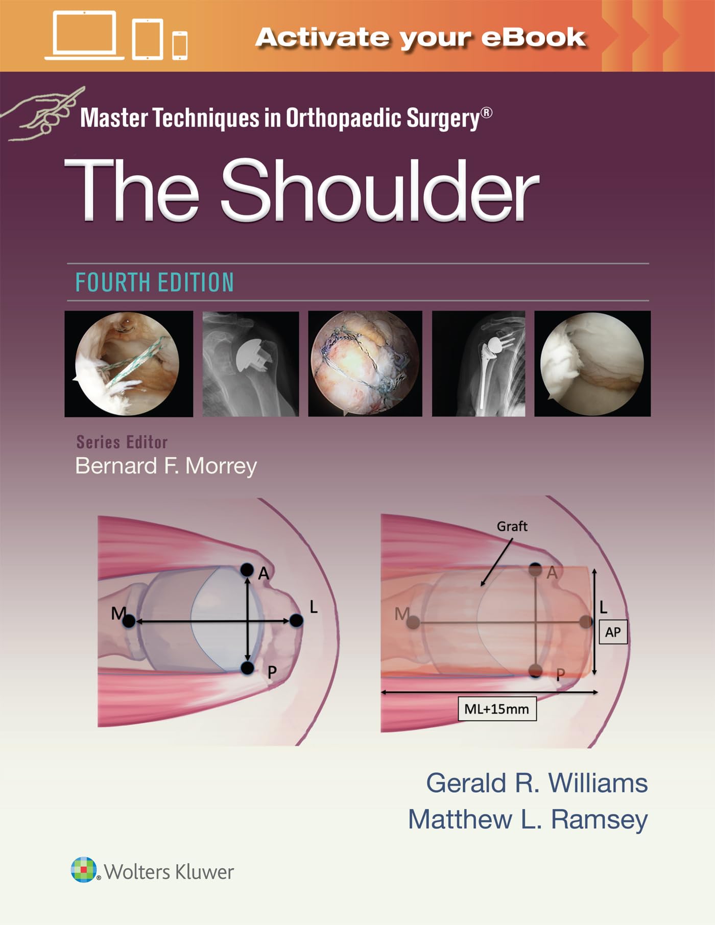 Master Techniques in Orthopaedic Surgery: The Shoulder: Print + eBook with Multimedia-ISBN: 9781975217969
