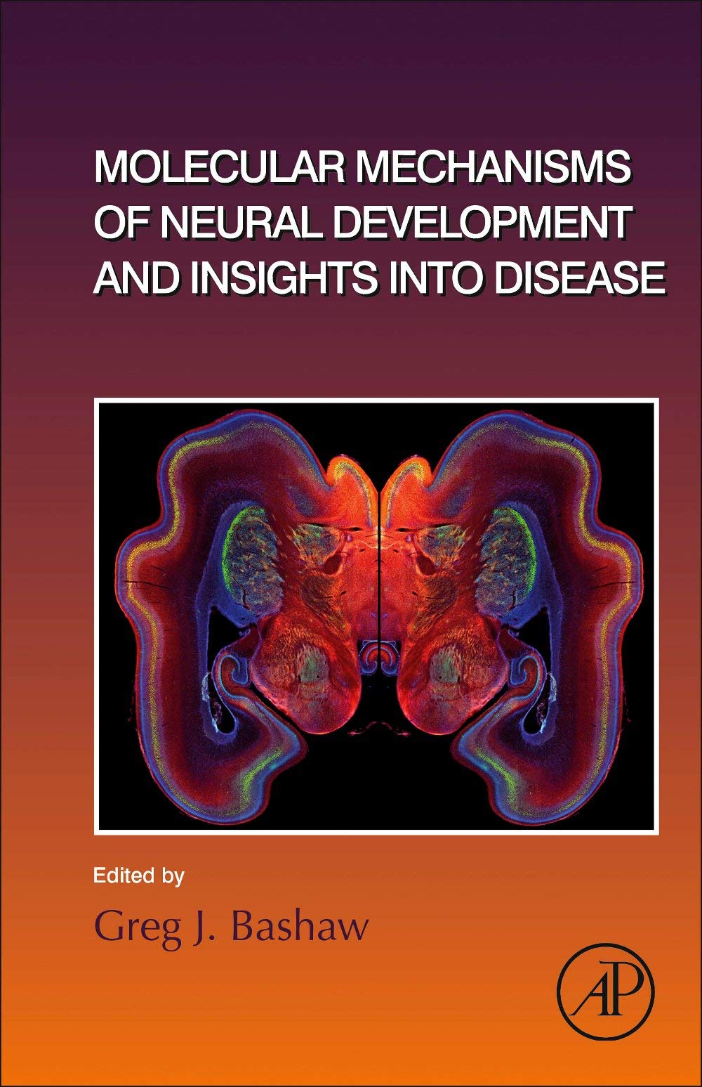 Molecular Mechanisms of Neural Development and Insights into Disease (Volume 142) (Current Topics in Developmental Biology