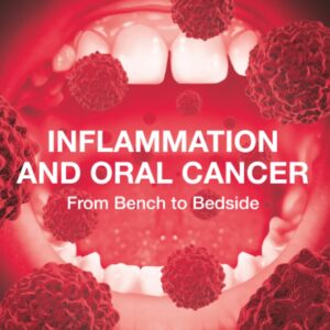 Inflammation and Oral Cancer: From Bench to Bedside