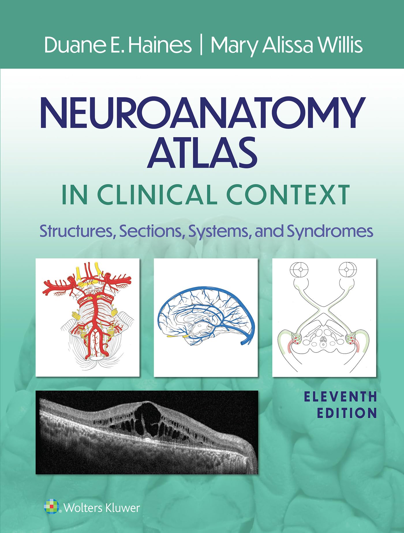 Neuroanatomy Atlas in Clinical Context: Structures