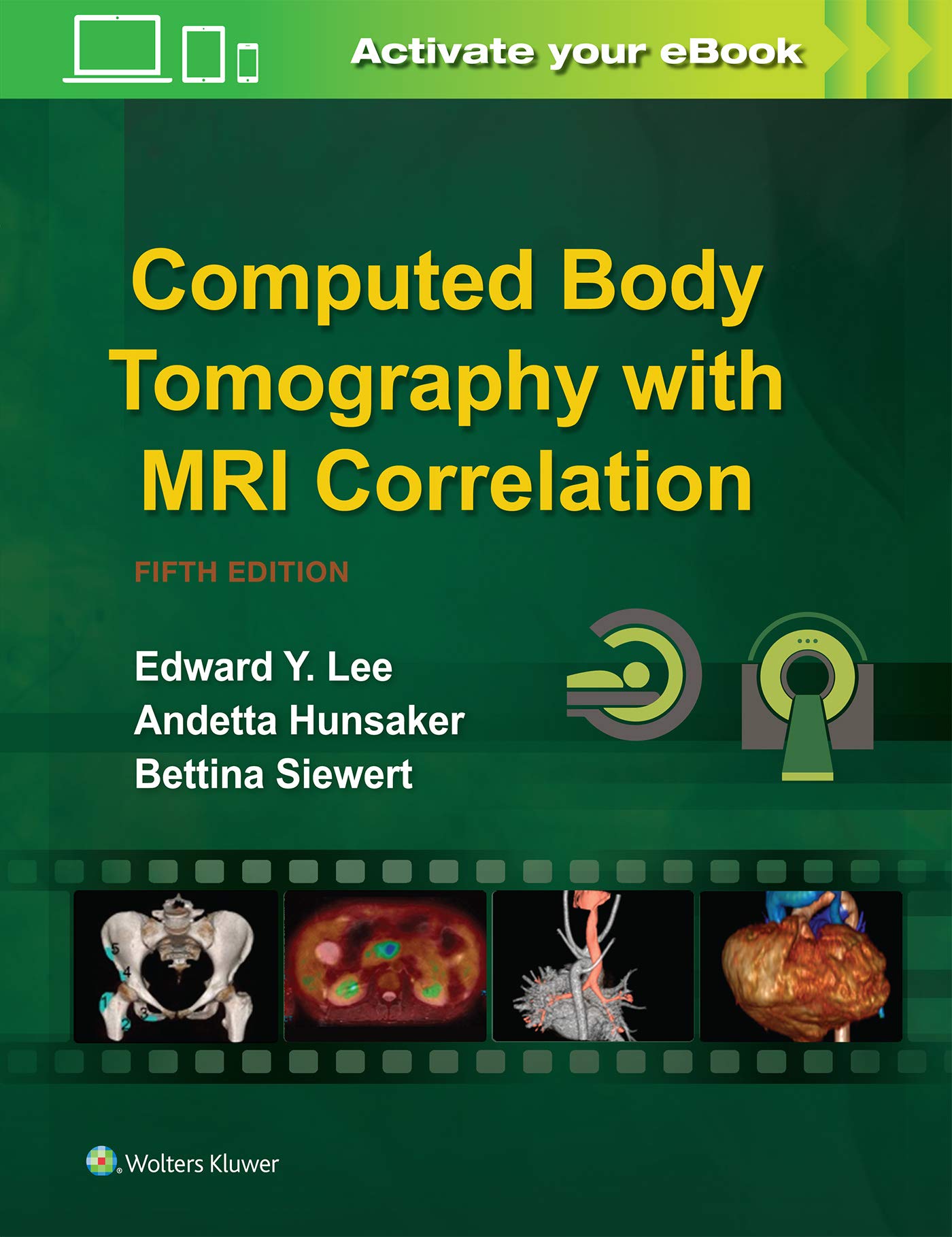 Computed Body Tomography with MRI Correlation-ISBN: 9781496370495