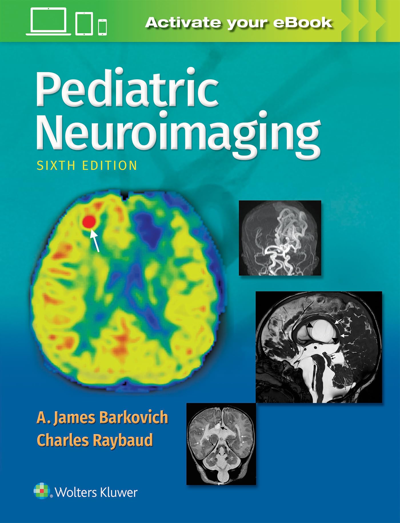 Pediatric Neuroimaging-ISBN: 9781496337207