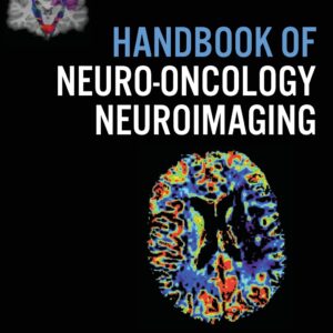 Handbook of Neuro-Oncology Neuroimaging