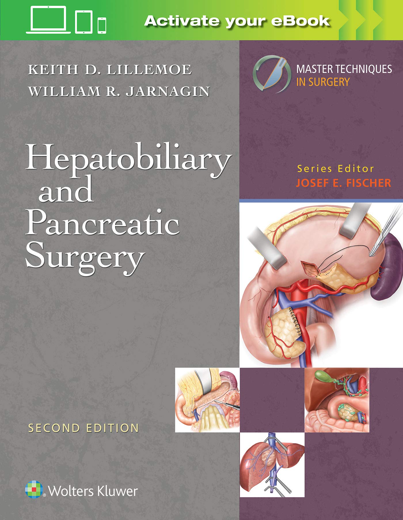 Master Techniques in Surgery: Hepatobiliary and Pancreatic Surgery-ISBN: 9781496385574