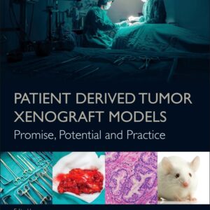 Patient Derived Tumor Xenograft Models: Promise