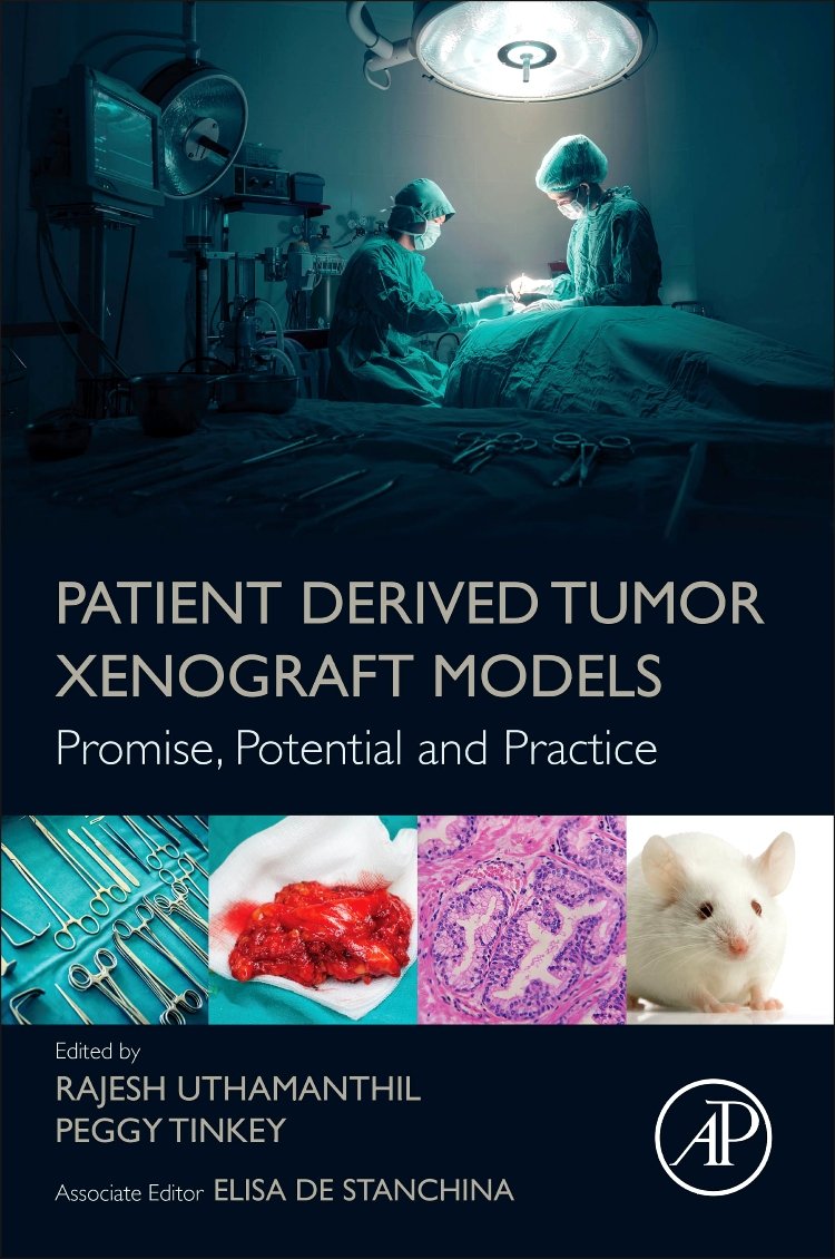 Patient Derived Tumor Xenograft Models: Promise