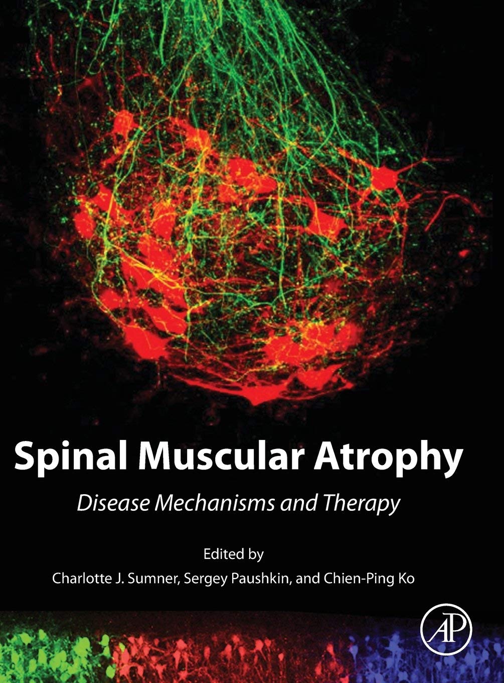 Spinal Muscular Atrophy: Disease Mechanisms and Therapy