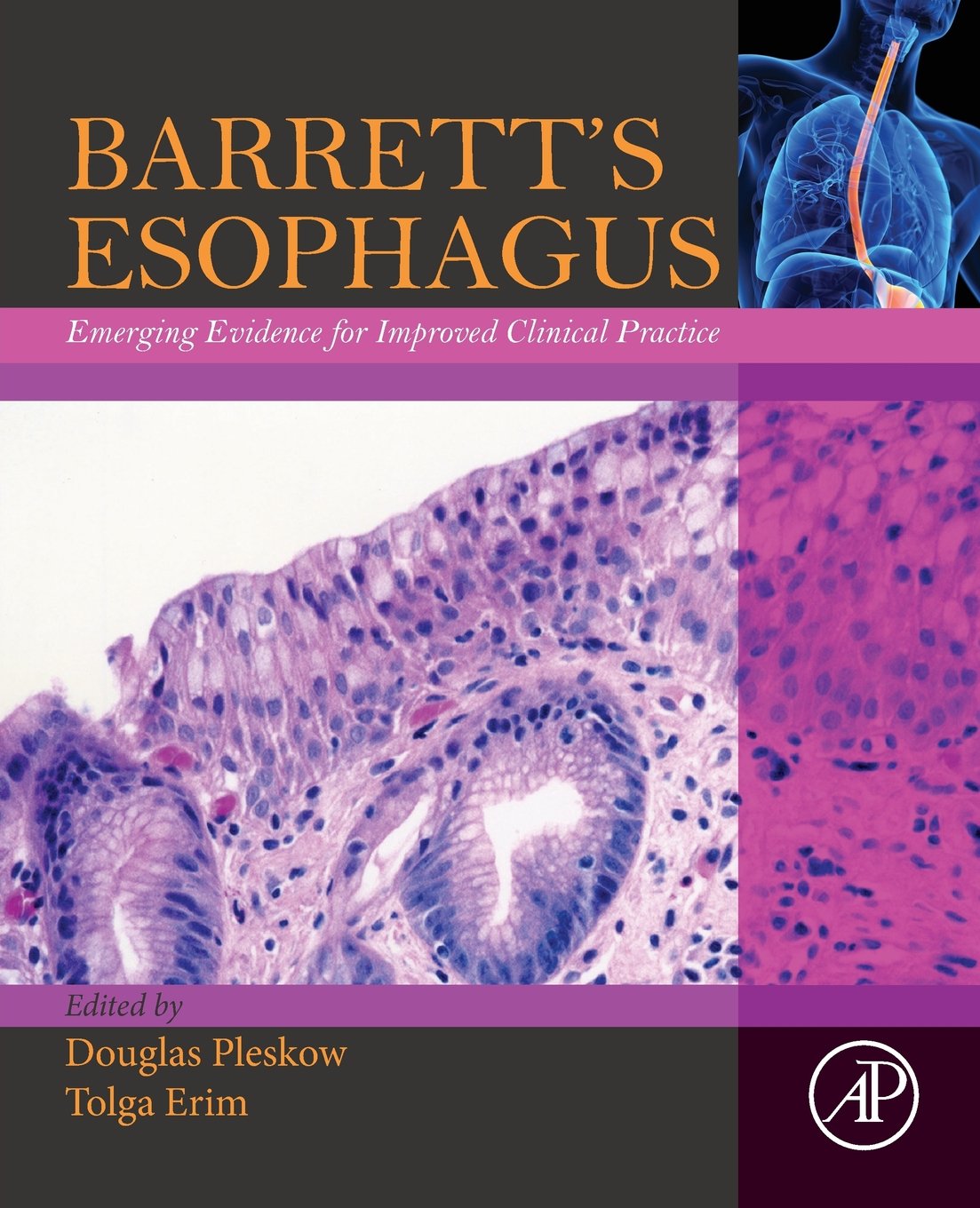 Barrett’s Esophagus: Emerging Evidence for Improved Clinical Practice