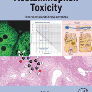Acetaminophen Toxicity: Experimental and Clinical Advances