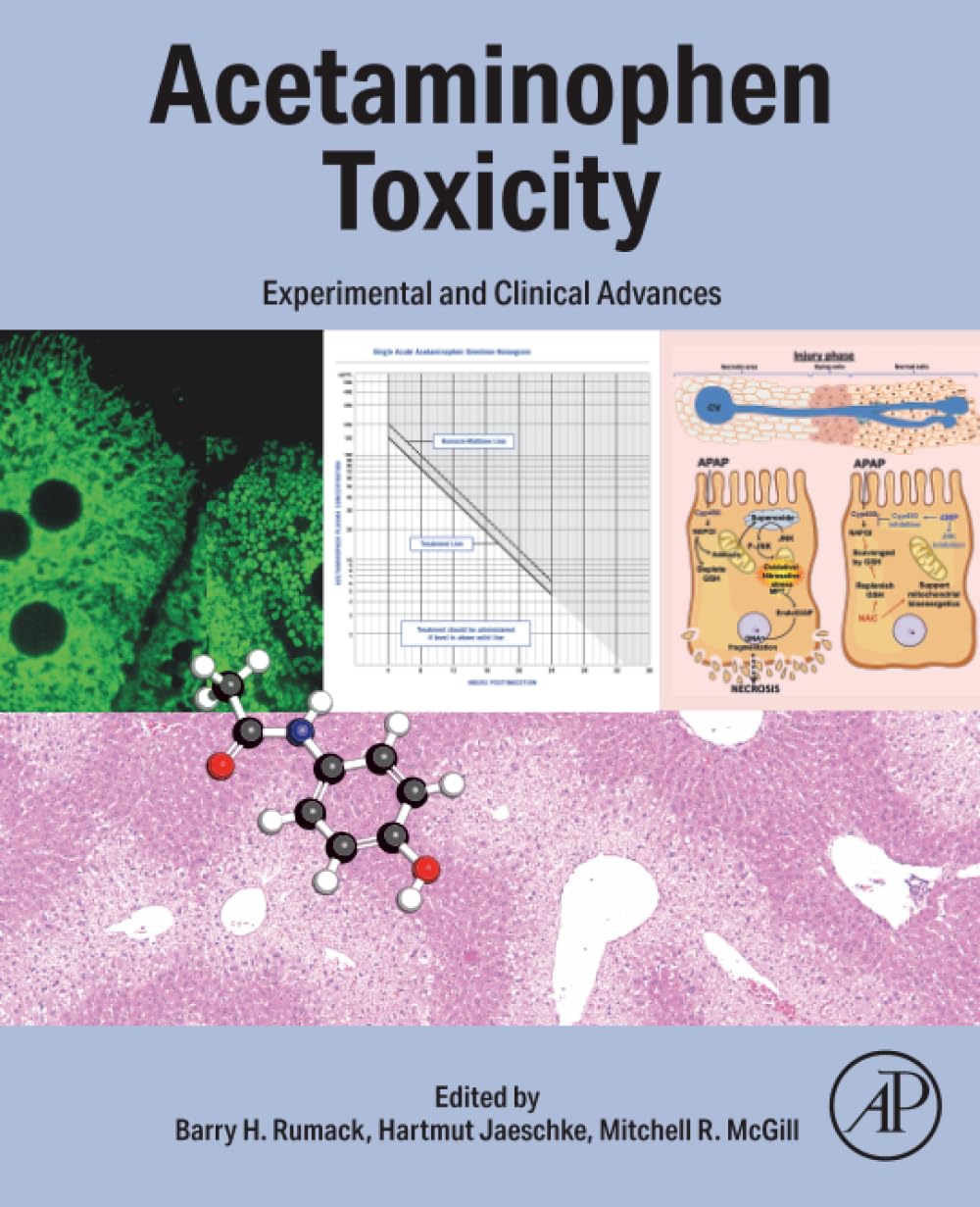 Acetaminophen Toxicity: Experimental and Clinical Advances