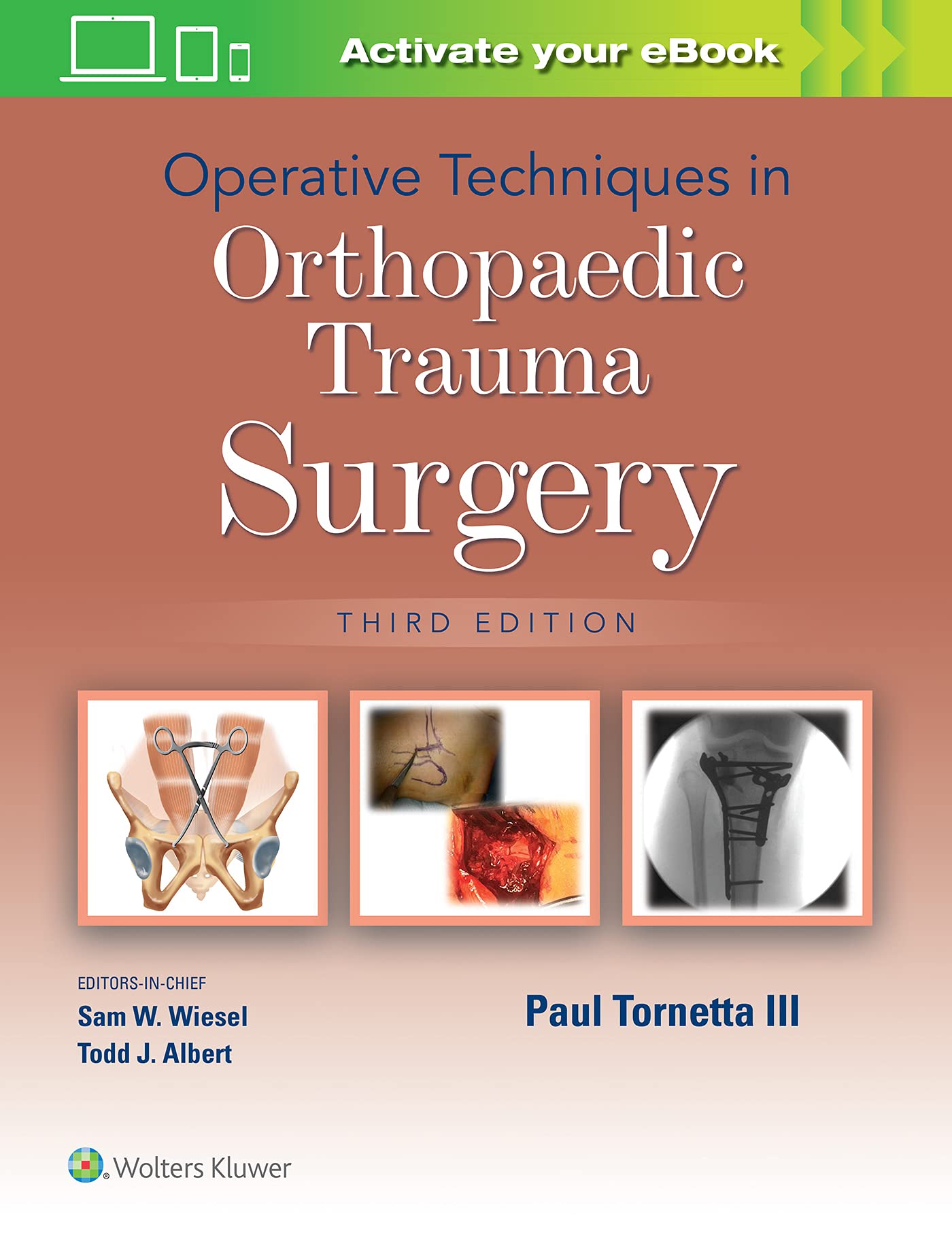 Operative Techniques in Orthopaedic Trauma Surgery-ISBN: 9781975172039