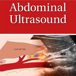 Pocket Anatomy & Protocols for Abdominal Ultrasound-ISBN: 9781975119416
