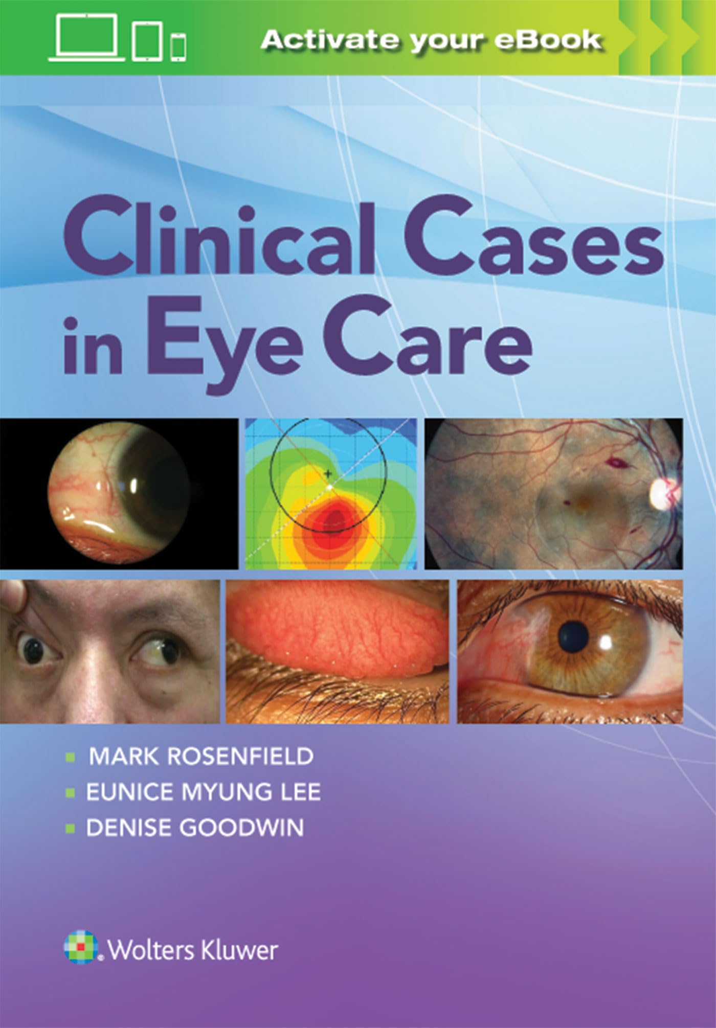 Clinical Cases in Eye Care-ISBN: 9781496385345