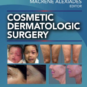 Cosmetic Dermatologic Surgery-ISBN: 9781496344168