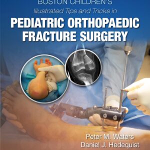 Boston Childrenâ€™s Illustrated Tips and Tricks in Pediatric Orthopaedic Fracture Surgery-ISBN: 9781975103859