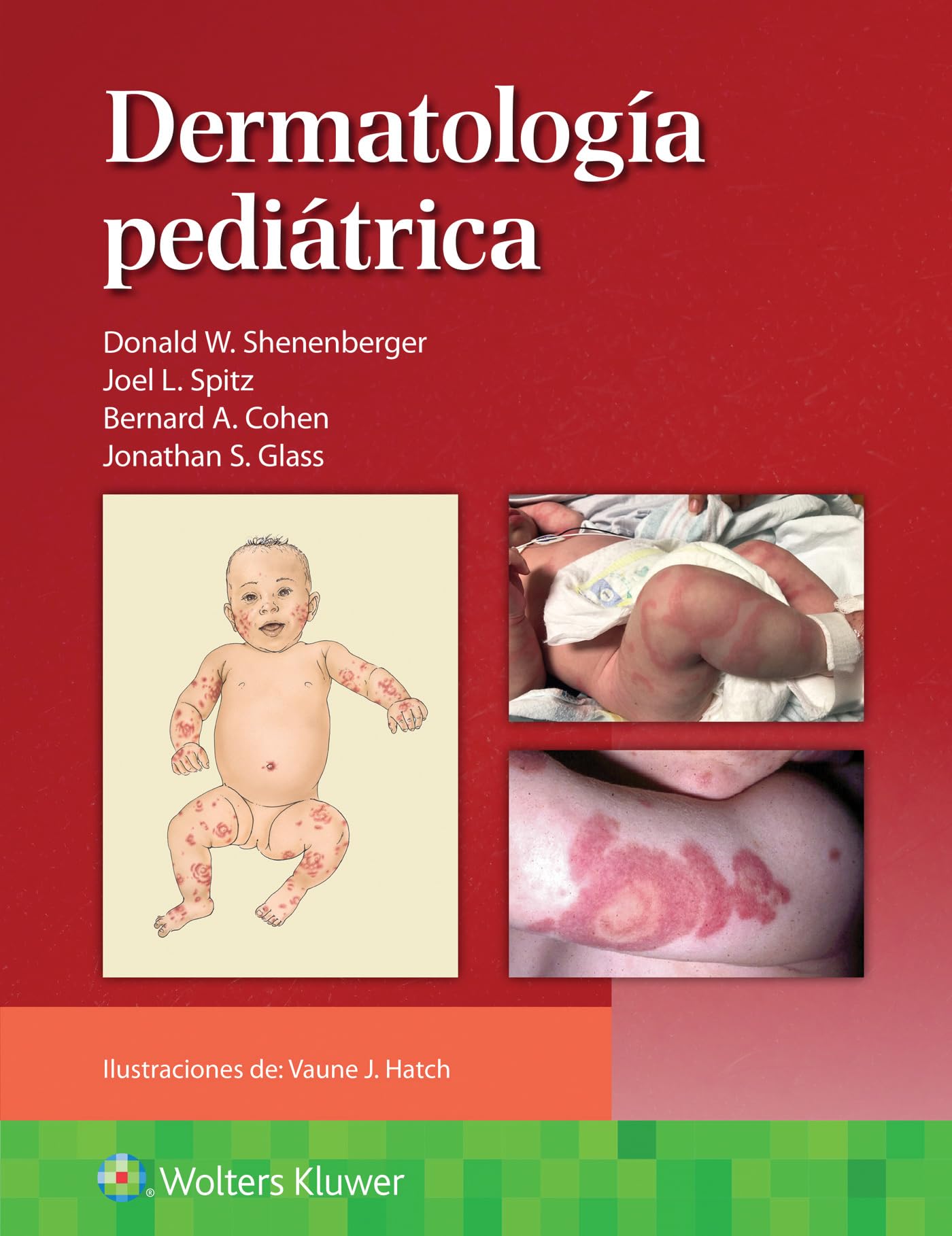 DermatologÃa pediátrica (Spanish Edition)-ISBN: 9788410022973