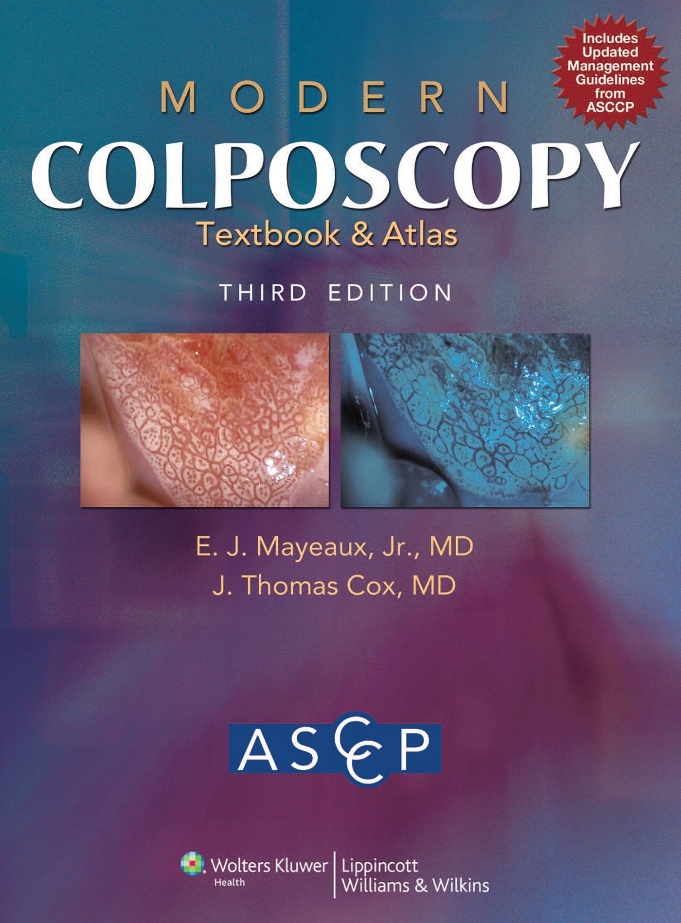 Modern Colposcopy Textbook and Atlas-ISBN: 9781608315475