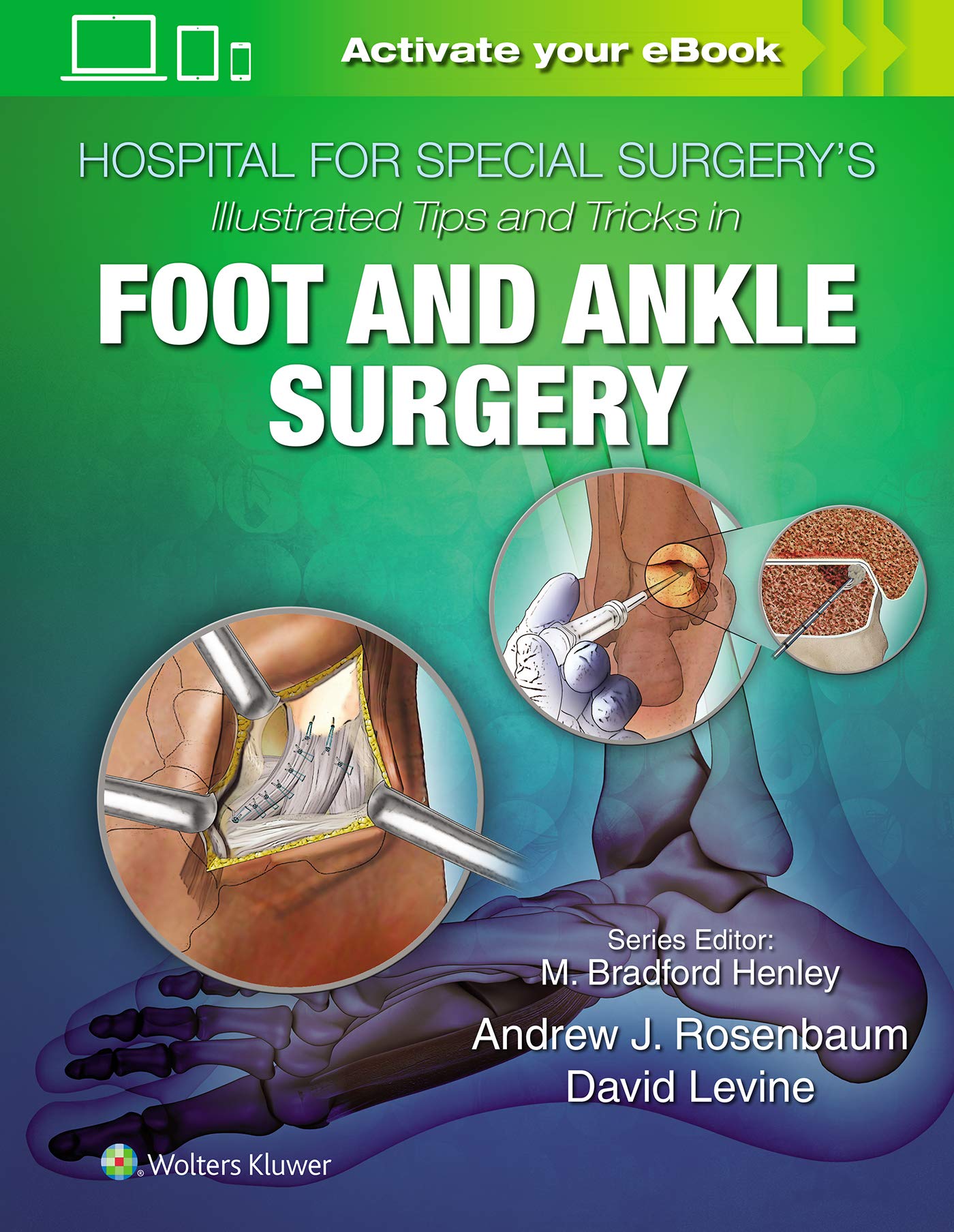 Hospital for Special Surgery's Illustrated Tips and Tricks in Foot and Ankle Surgery-ISBN: 9781496365101
