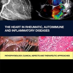 The Heart in Rheumatic
