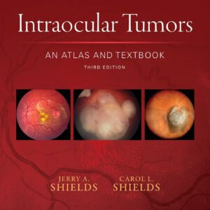 Intraocular Tumors: An Atlas and Textbook (Volume 1)-ISBN: 9781496321343