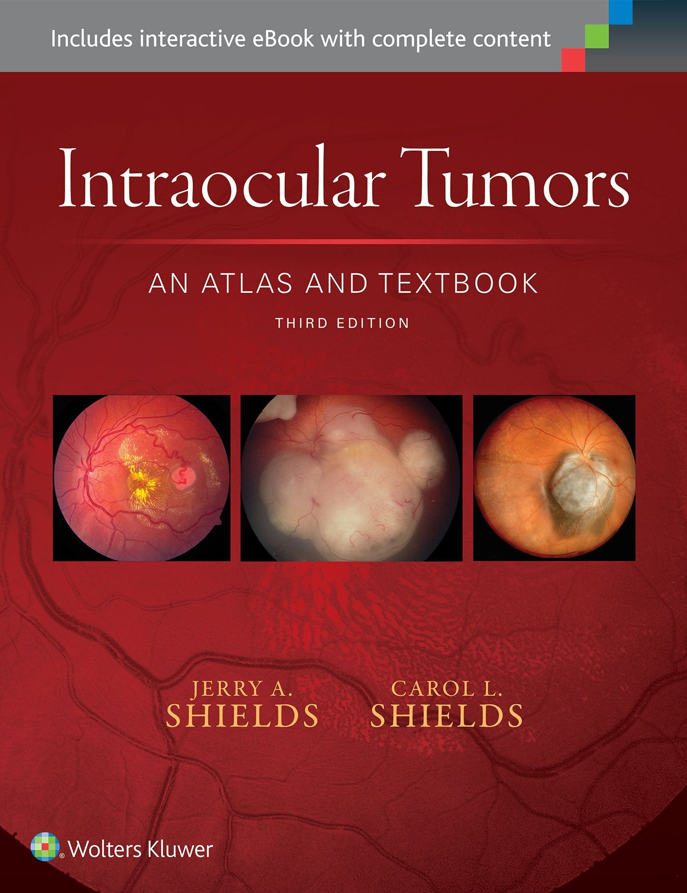 Intraocular Tumors: An Atlas and Textbook (Volume 1)-ISBN: 9781496321343