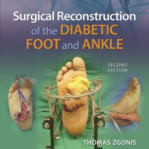 Surgical Reconstruction of the Diabetic Foot and Ankle-ISBN: 9781496330079