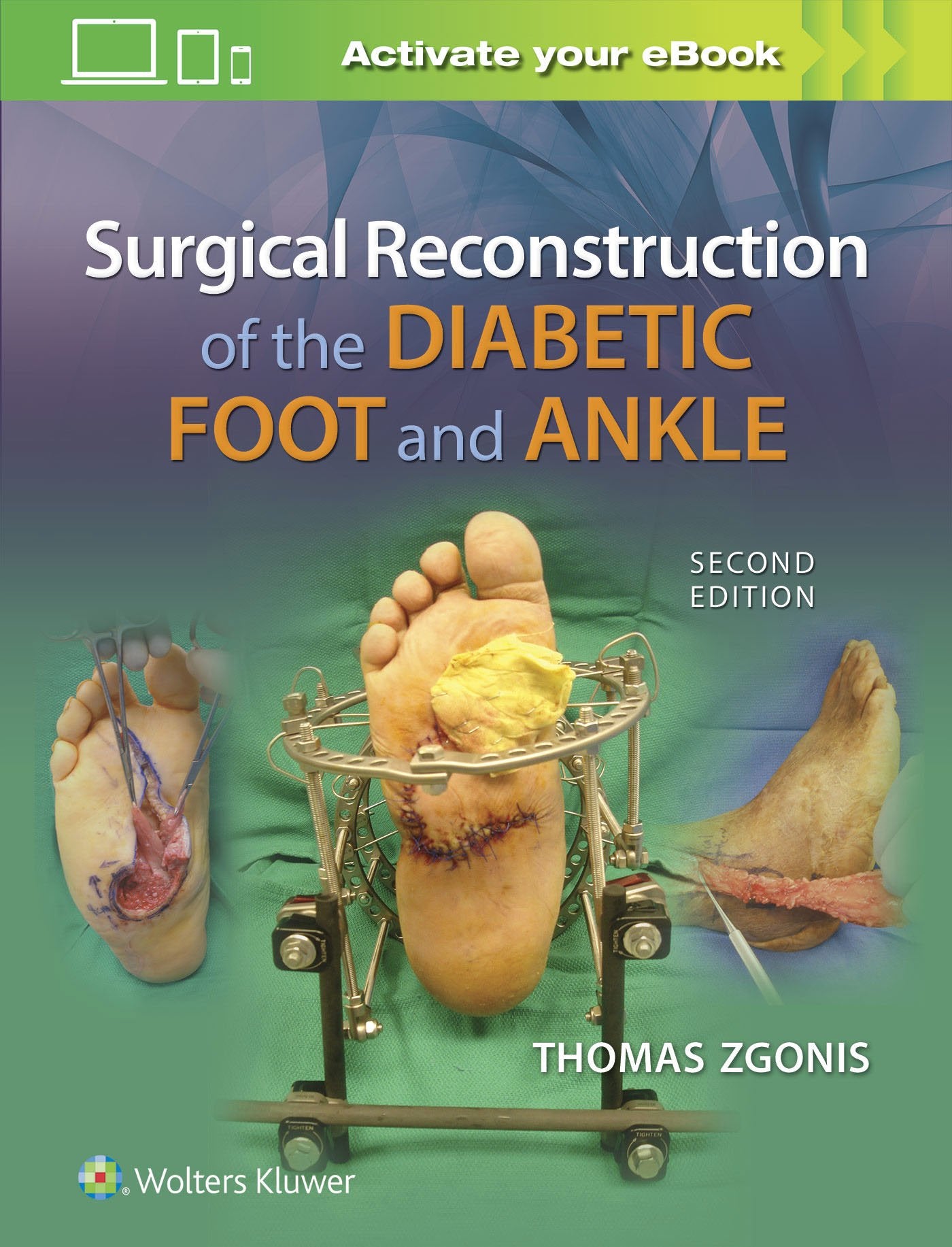 Surgical Reconstruction of the Diabetic Foot and Ankle-ISBN: 9781496330079
