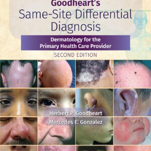 Goodheart's Same-Site Differential Diagnosis: Dermatology for the Primary Health Care Provider-ISBN: 9781975161330