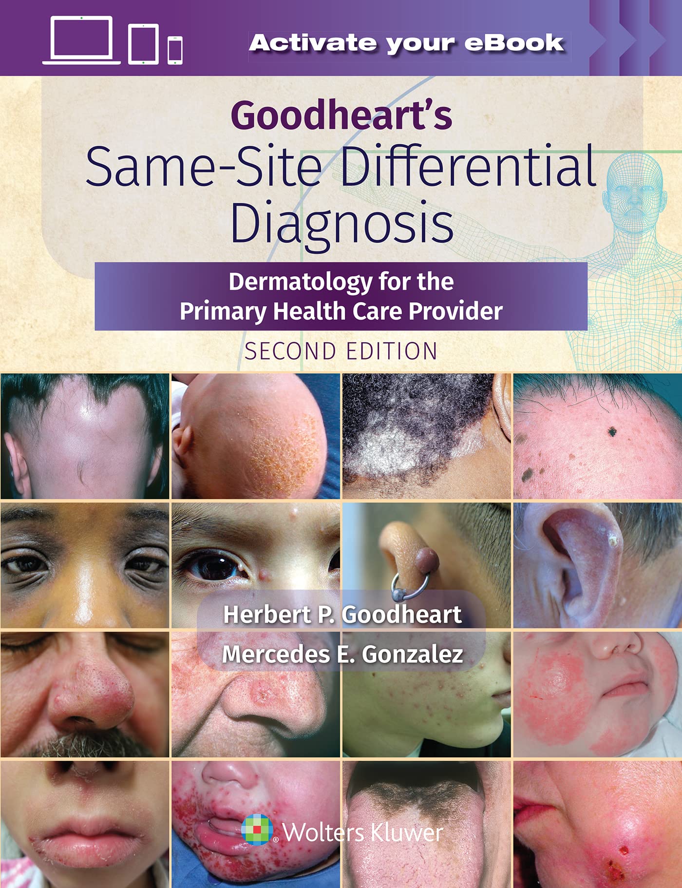 Goodheart's Same-Site Differential Diagnosis: Dermatology for the Primary Health Care Provider-ISBN: 9781975161330