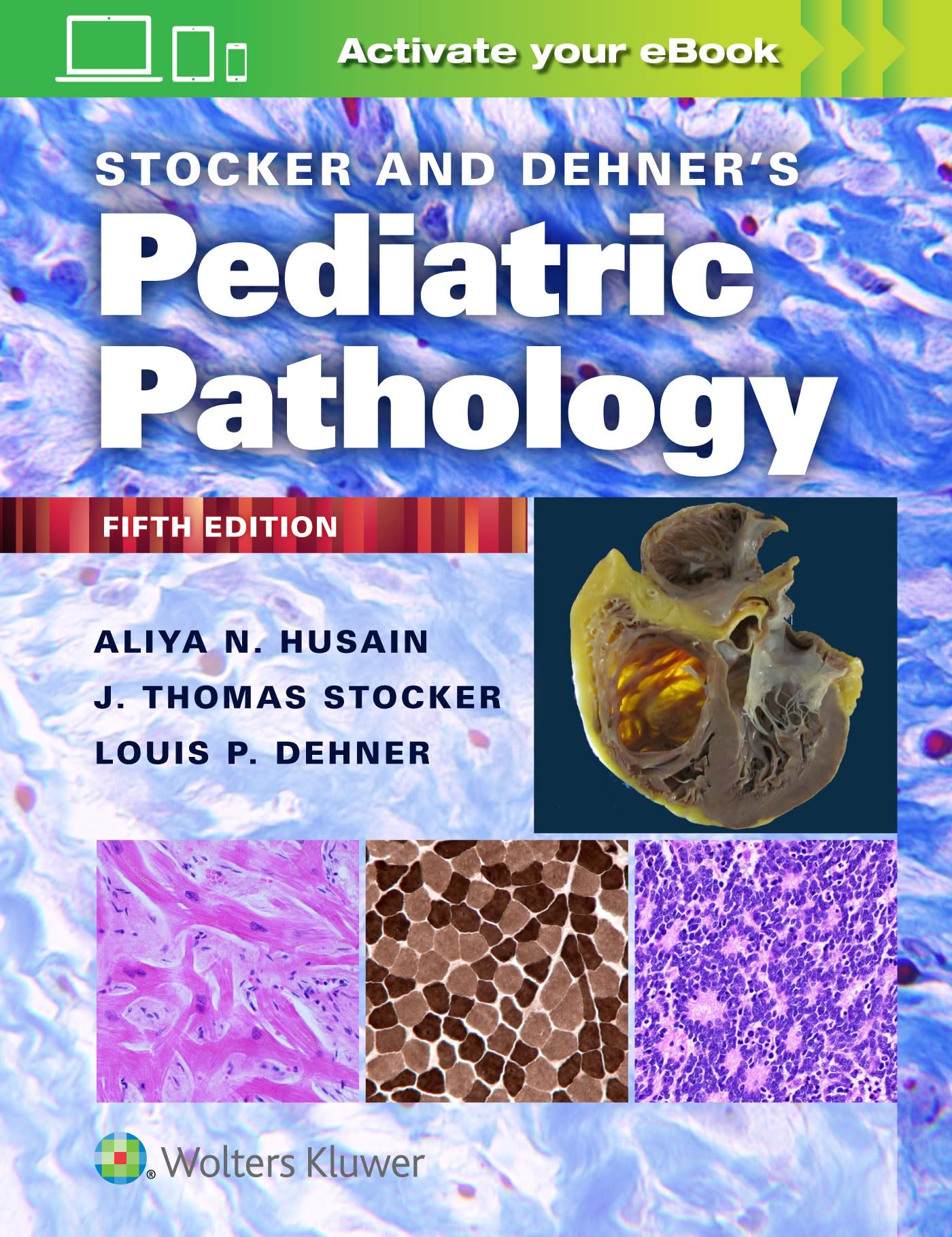 Stocker and Dehner's Pediatric Pathology-ISBN: 9781975144814
