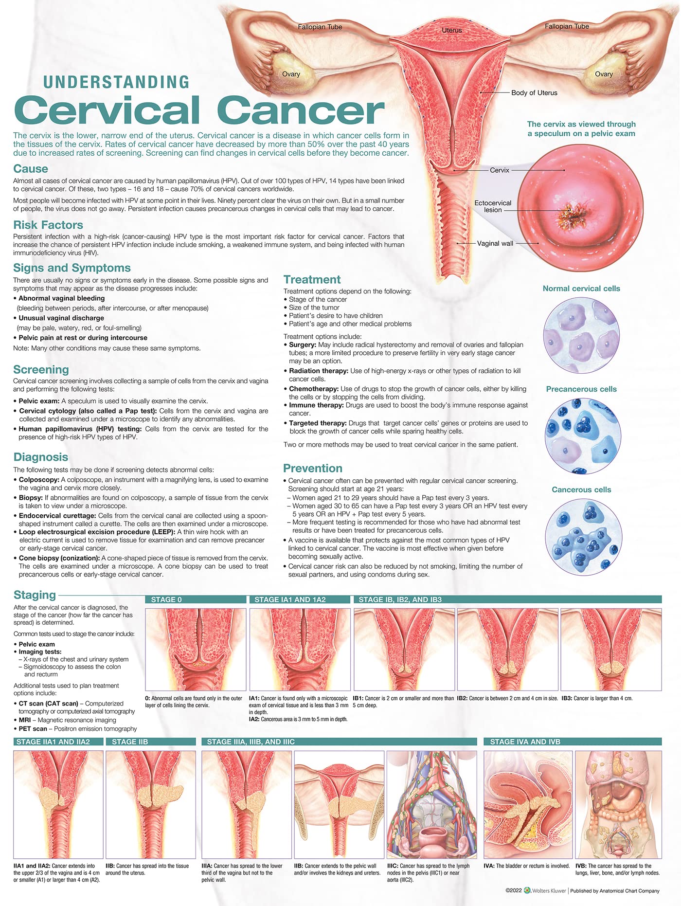 Understanding Cervical Cancer Anatomical Chart-ISBN: 9781975192334