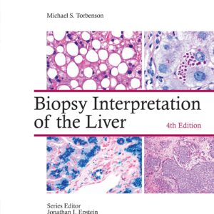 Biopsy Interpretation of the Liver-ISBN: 9781975157296