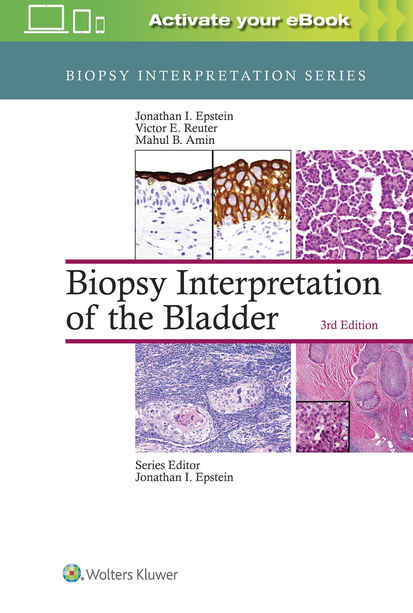 Biopsy Interpretation of the Bladder-ISBN: 9781496315045