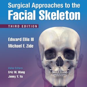 Surgical Approaches to the Facial Skeleton-ISBN: 9781496380418