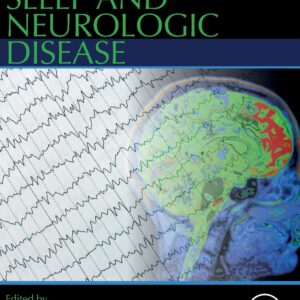 Sleep and Neurologic Disease