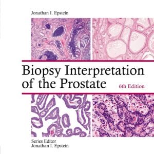 Biopsy Interpretation of the Prostate-ISBN: 9781975136543