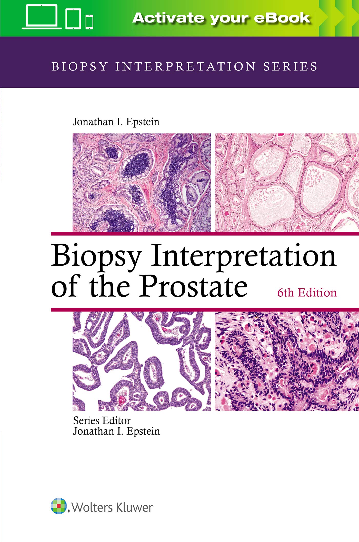 Biopsy Interpretation of the Prostate-ISBN: 9781975136543