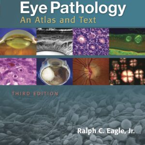 Eye Pathology: An Atlas and Text-ISBN: 9781496337177