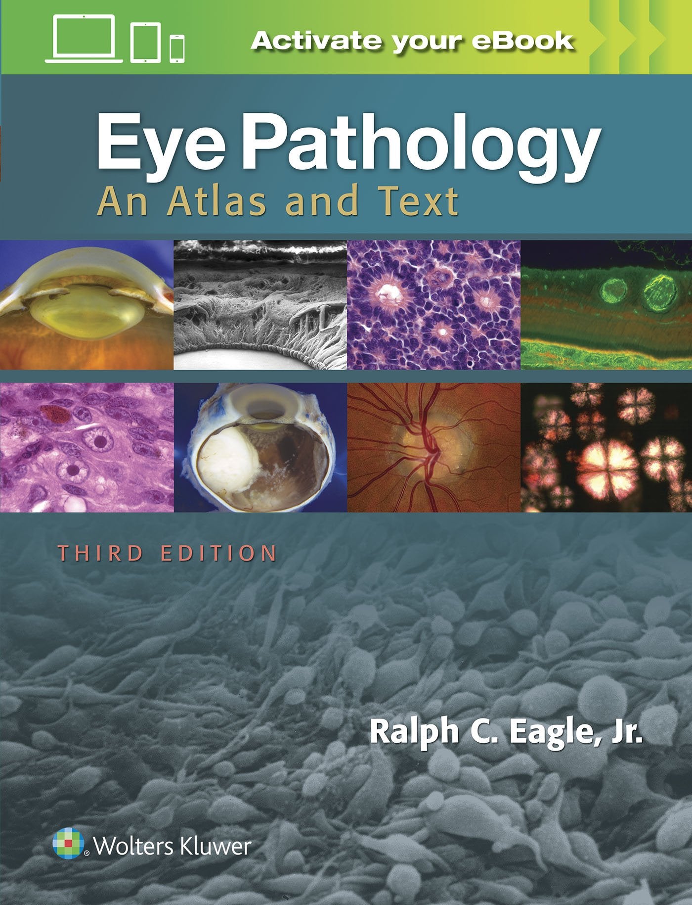 Eye Pathology: An Atlas and Text-ISBN: 9781496337177