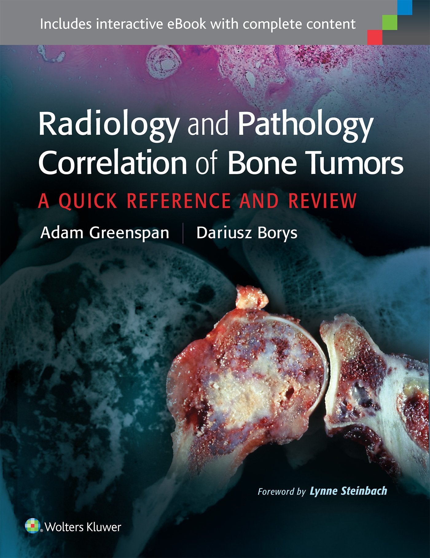 Radiology and Pathology Correlation of Bone Tumors: A Quick Reference and Review-ISBN: 9781469898872