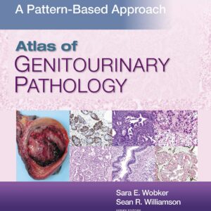 Atlas of Genitourinary Pathology: A Pattern Based Approach-ISBN: 9781496397669