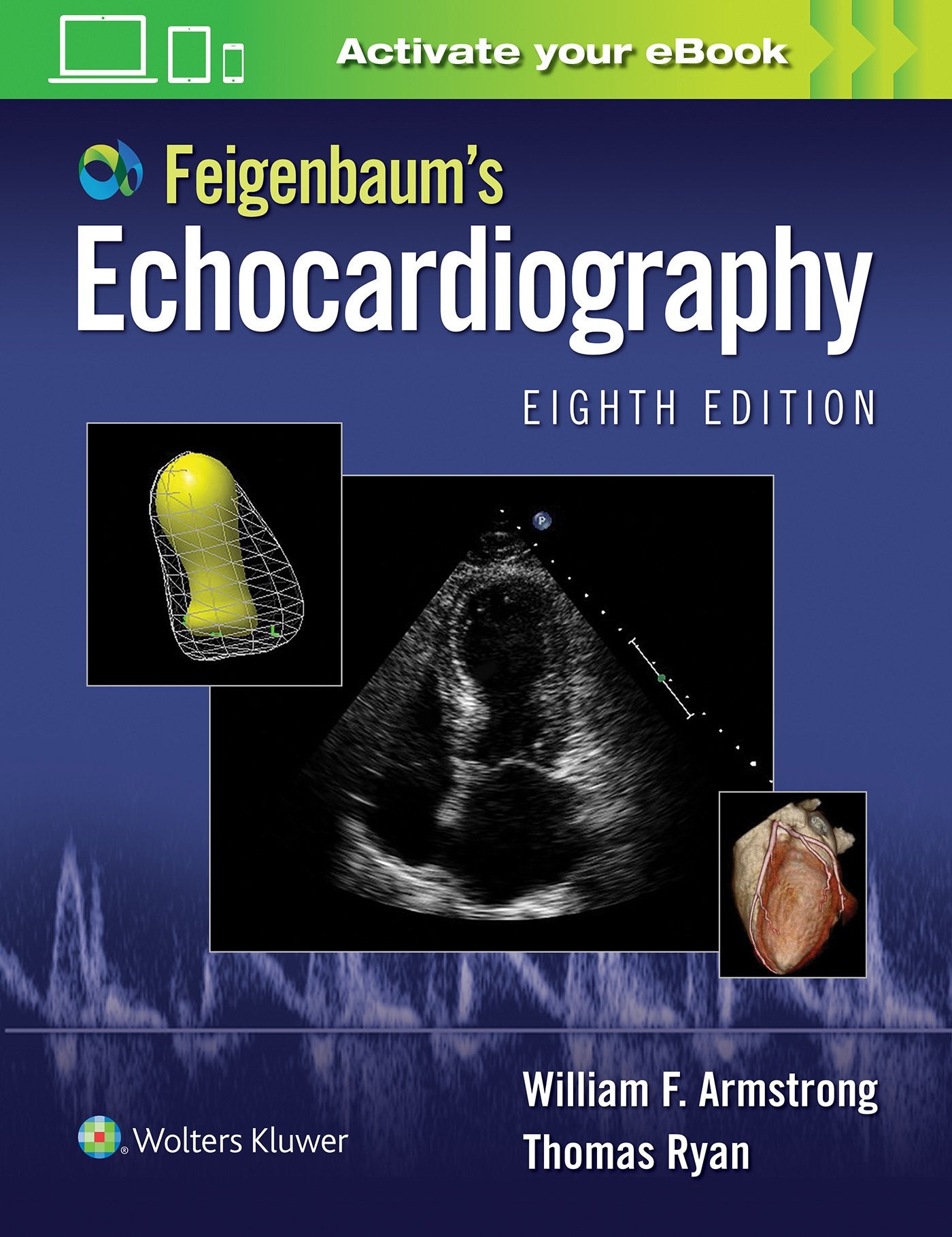 Feigenbaum's Echocardiography-ISBN: 9781451194272