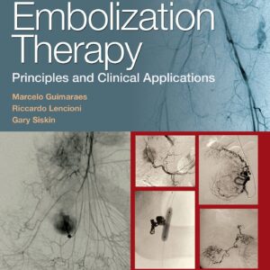 Embolization Therapy: Principles and Clinical Applications-ISBN: 9781451191448