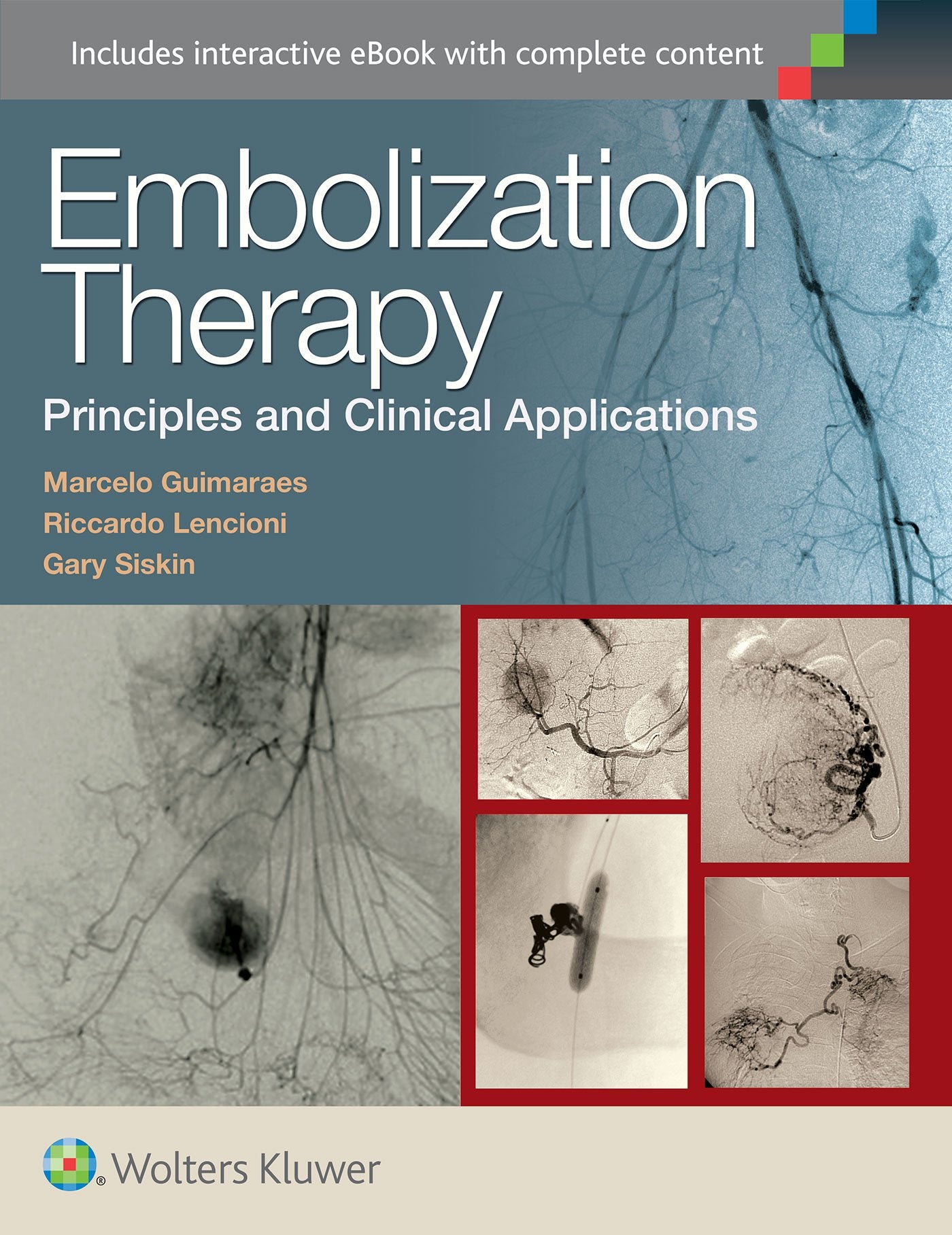 Embolization Therapy: Principles and Clinical Applications-ISBN: 9781451191448
