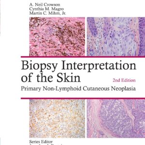 Biopsy Interpretation of the Skin: Primary Non-Lymphoid Cutaneous Neoplasia-ISBN: 9781496365132