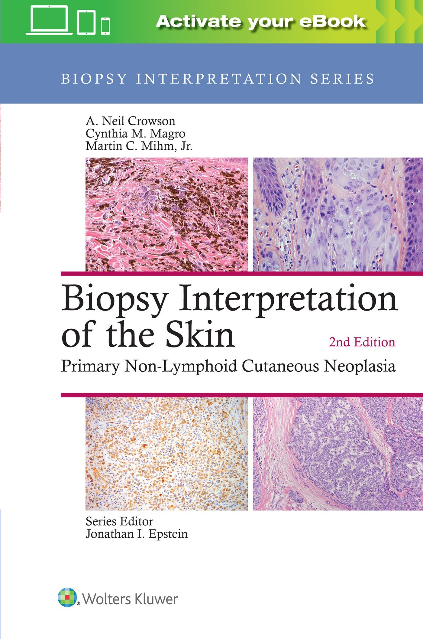 Biopsy Interpretation of the Skin: Primary Non-Lymphoid Cutaneous Neoplasia-ISBN: 9781496365132