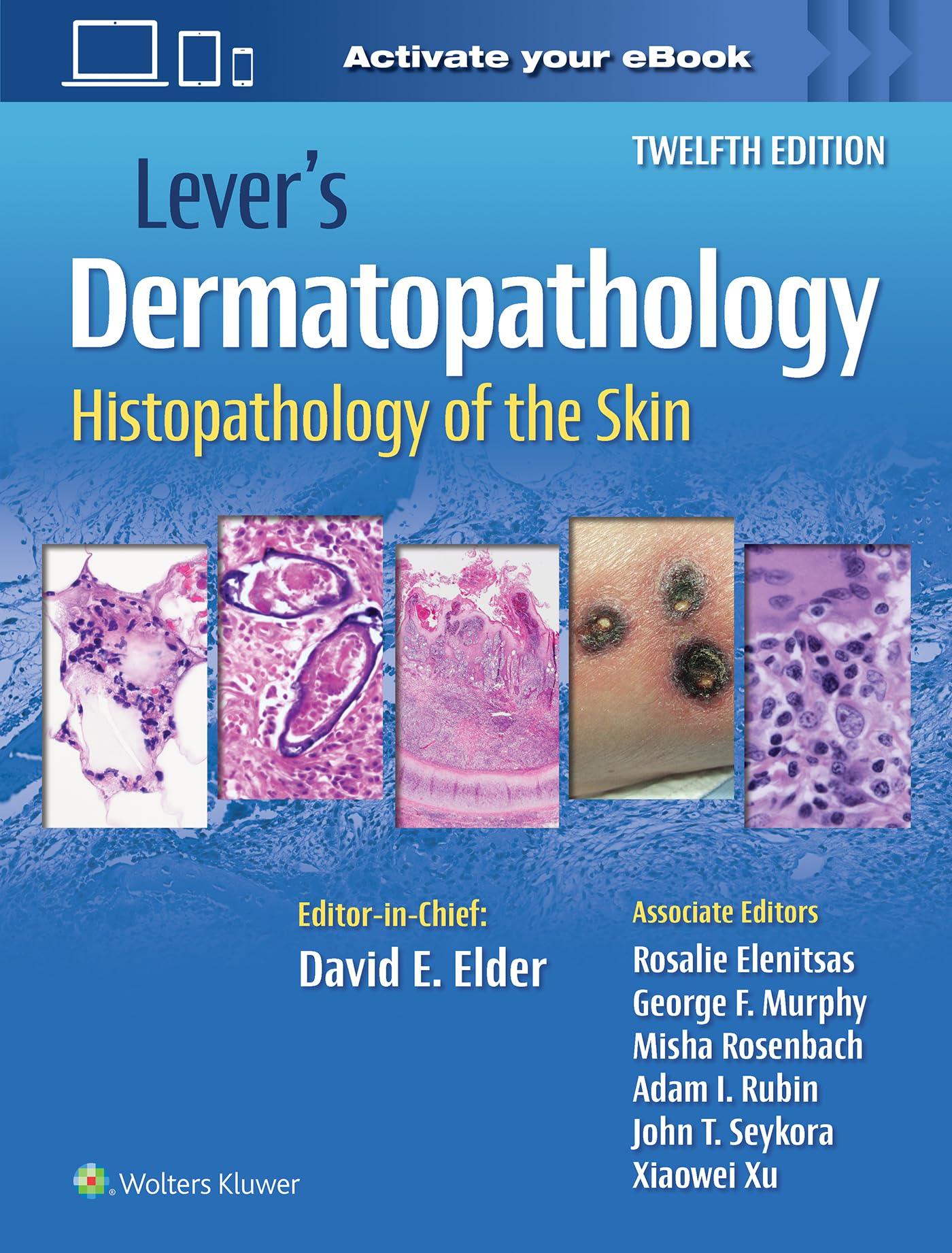 Lever's Dermatopathology: Histopathology of the Skin-ISBN: 9781975174491