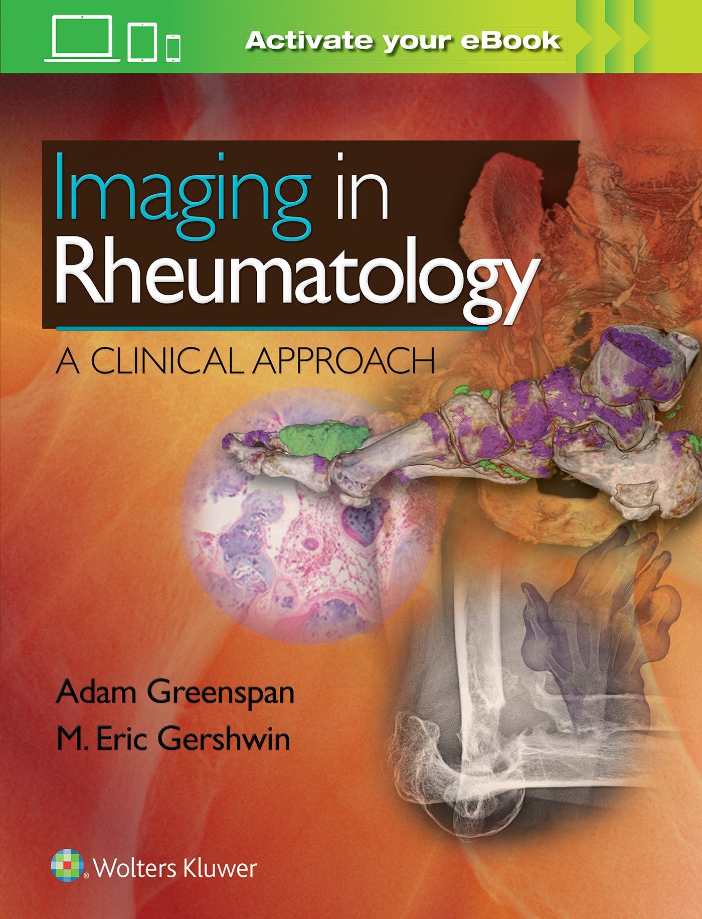 Imaging in Rheumatology: A Clinical Approach-ISBN: 9781496367631