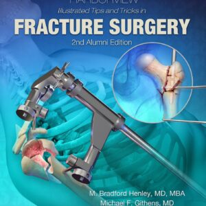 Harborview Illustrated Tips and Tricks in Fracture Surgery-ISBN: 9781496355980