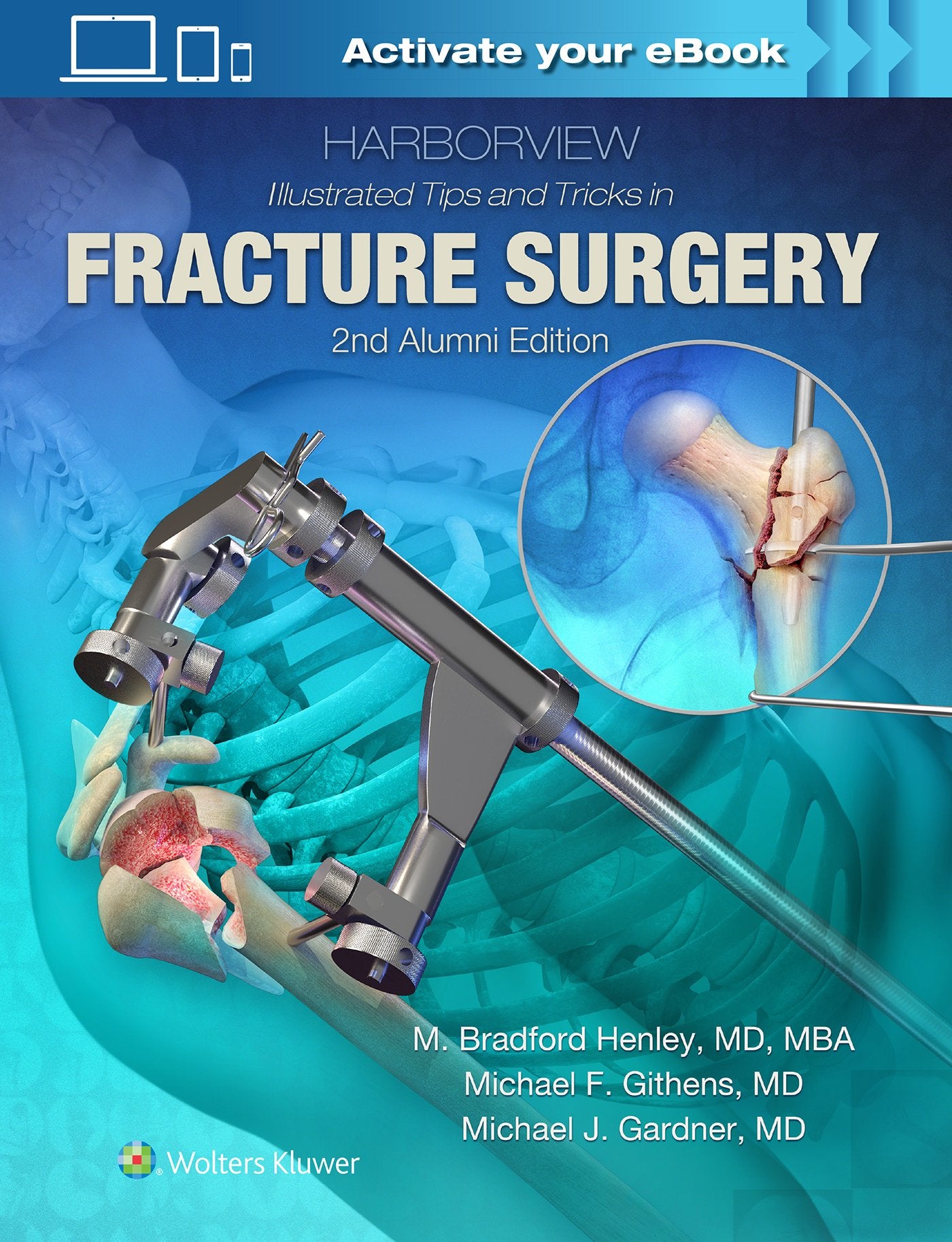 Harborview Illustrated Tips and Tricks in Fracture Surgery-ISBN: 9781496355980